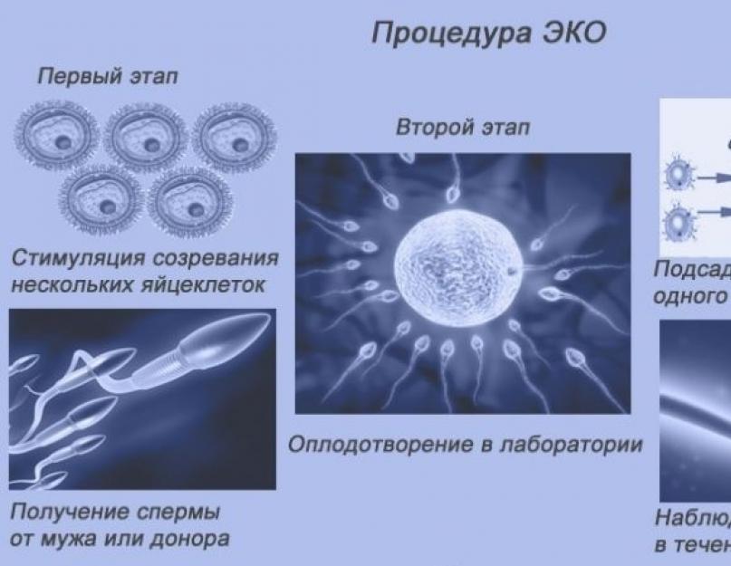 Вагітність після стерилізації?  Чи можна завагітніти після стерилізації маткових труб природним шляхом?  Чи можлива вагітність при стерилізації маткових труб